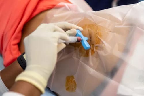 Aspirado/biopsia de médula ósea
